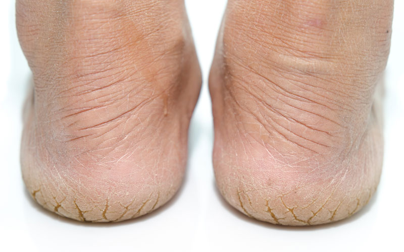 importance of skincare