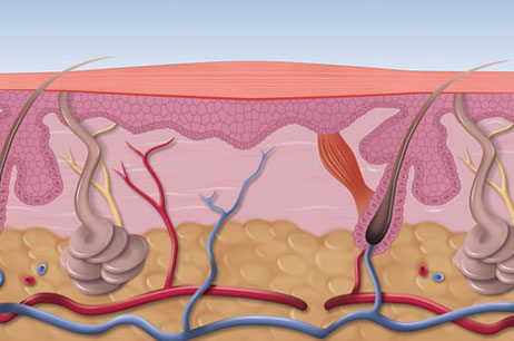 microwave therapy fig3